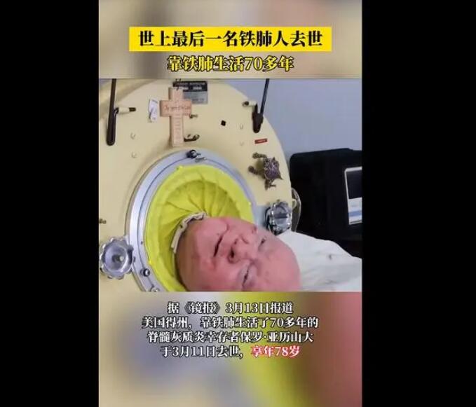 世上最后一名铁肺人去世