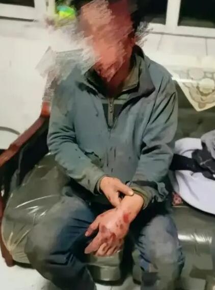 67岁老人做工讨薪被打致轻伤二级
